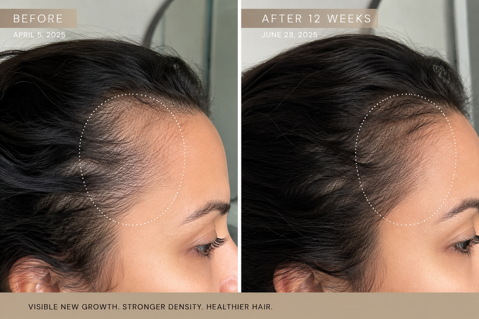 Hair Angel Oil before and after showing fuller-looking hair and improved density